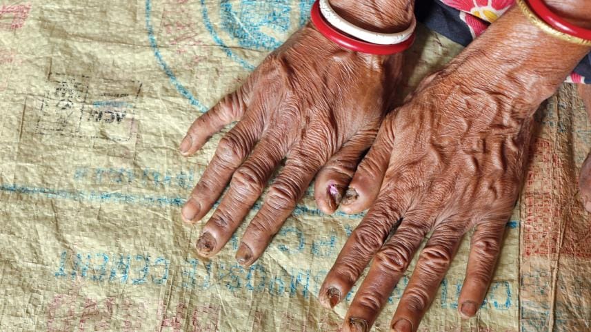 Climate-sensitive diseases can move beyond old categories of urban and rural, seasonal and exceptional.