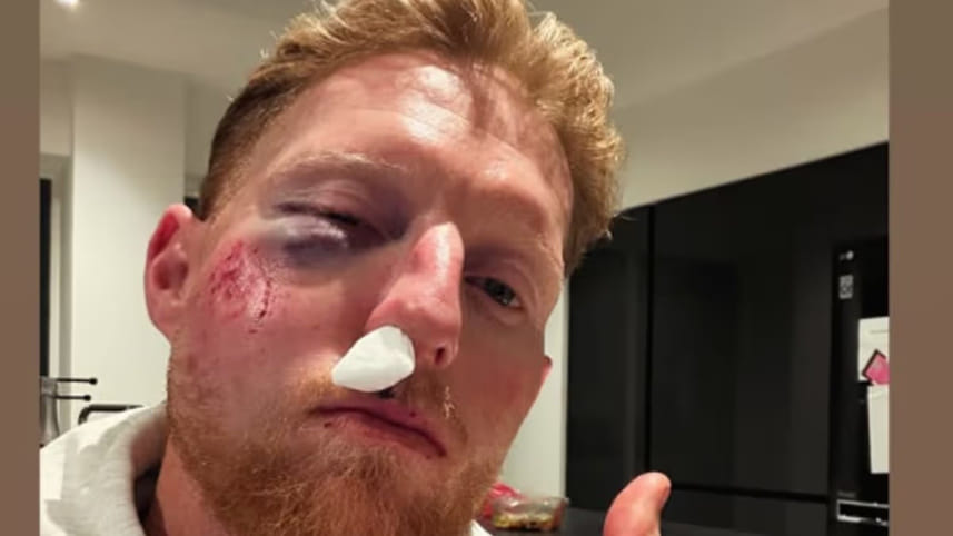 Ben Stokes Injury.jpg