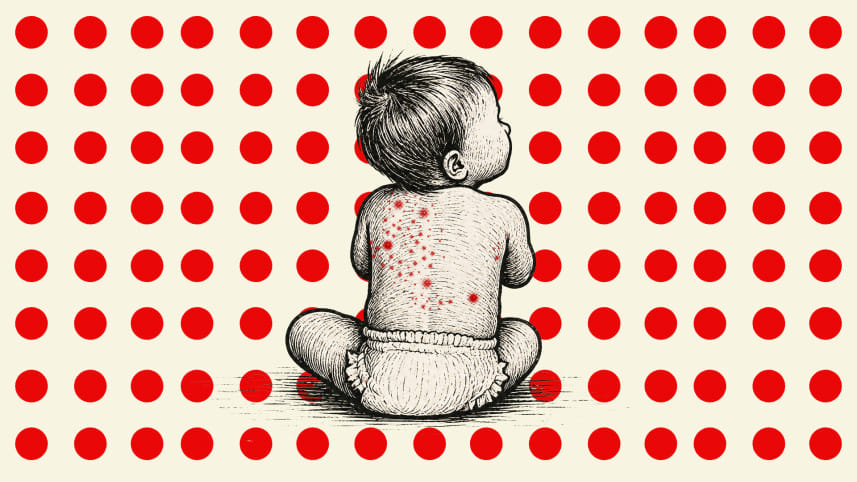 Bangladesh measles death toll 2026
