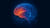 Alzheimers-detection.jpg