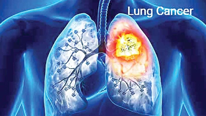 lung.jpg