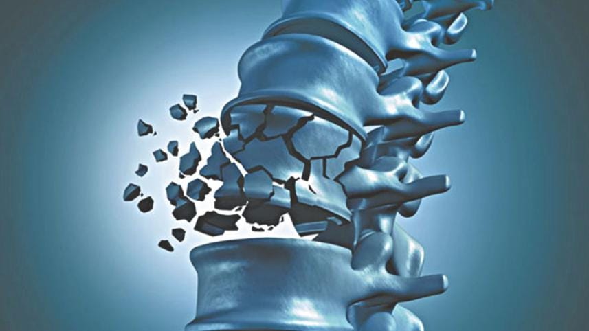 Osteoporosis treatment