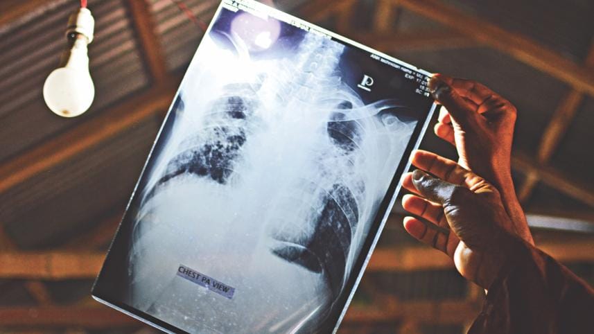 Burimari union 2.jpg