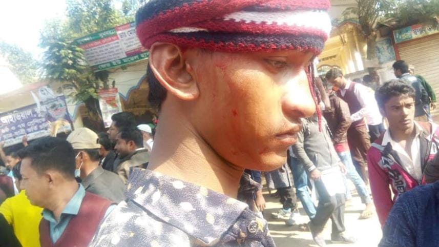 BNP campaign attacked in Khagrachhari