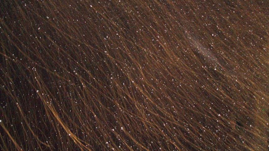 Tips to cure dandruff this winter 