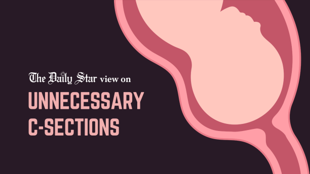 Unnecessary C sections