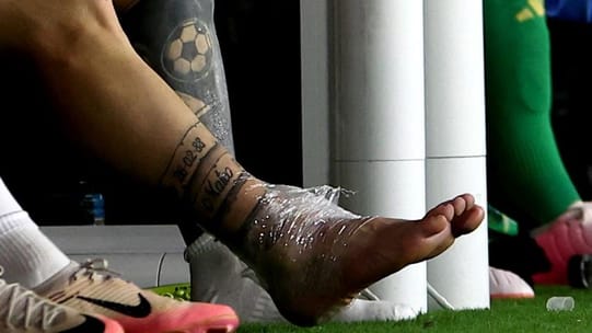 Lionel Messi injury update Copa America 2024