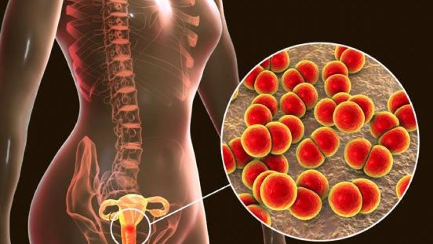 UR for 14 feb 2025.jpg