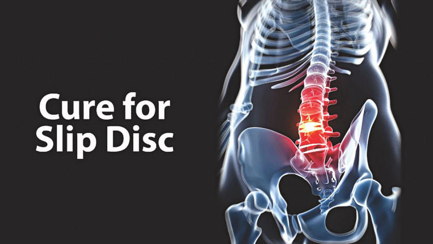 Vertebral disc prolapse Vertebral disc prolapse