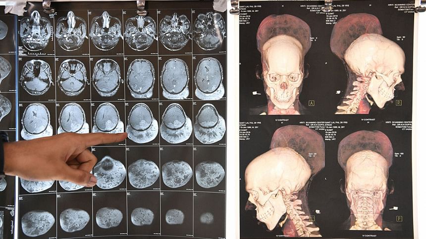 Heaviest tumour Heaviest tumour