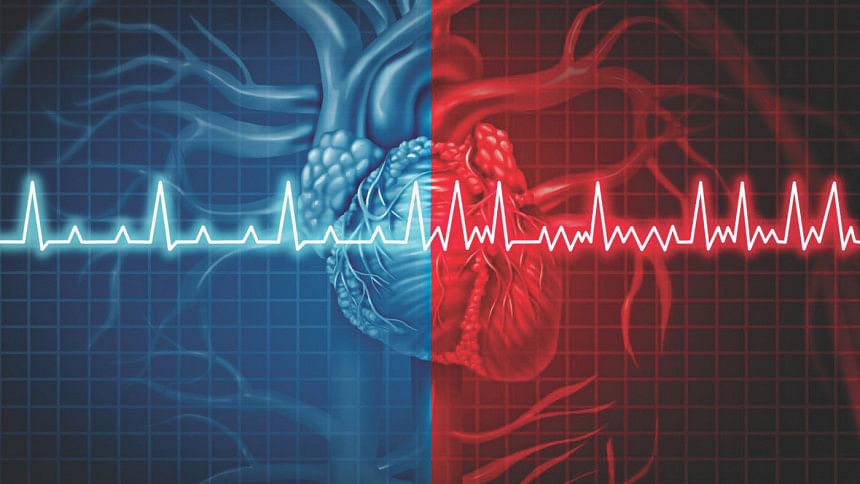 Functional disease of heart Functional disease of heart