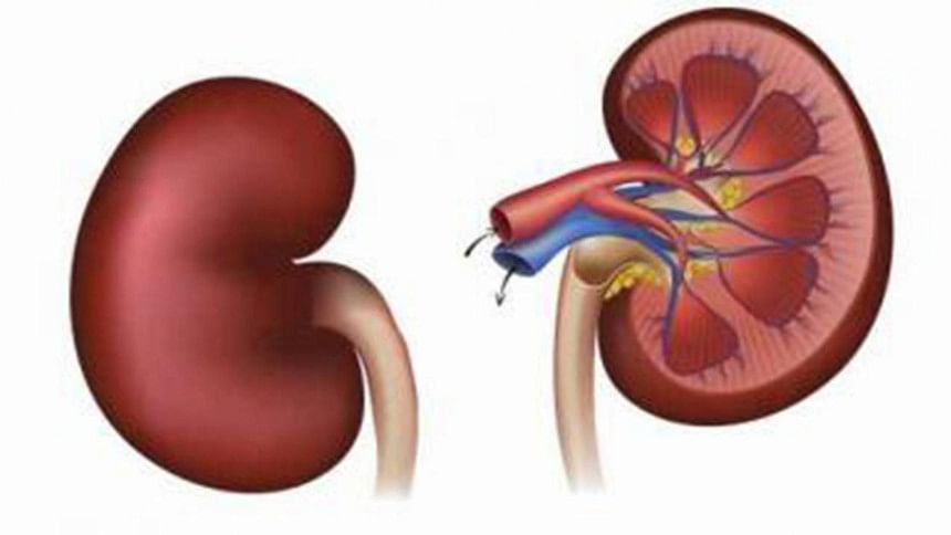 kidney decease kidney decease
