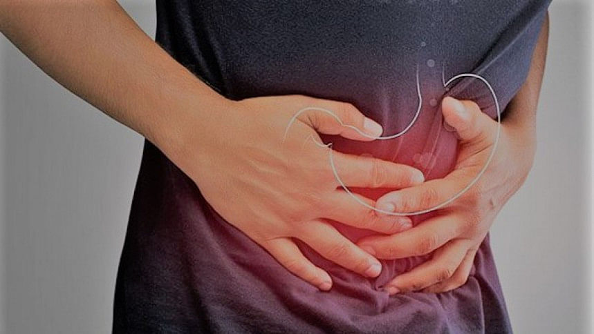 Medicine overuse to treat gastric issues may cause serious side effects: BSMMU doctors Medicine overuse to treat gastric issues may cause serious side effects: BSMMU doctors
