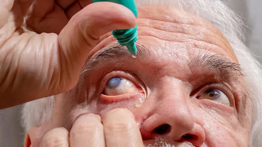 Halt glaucoma progression by regular eye exams | The Daily Star