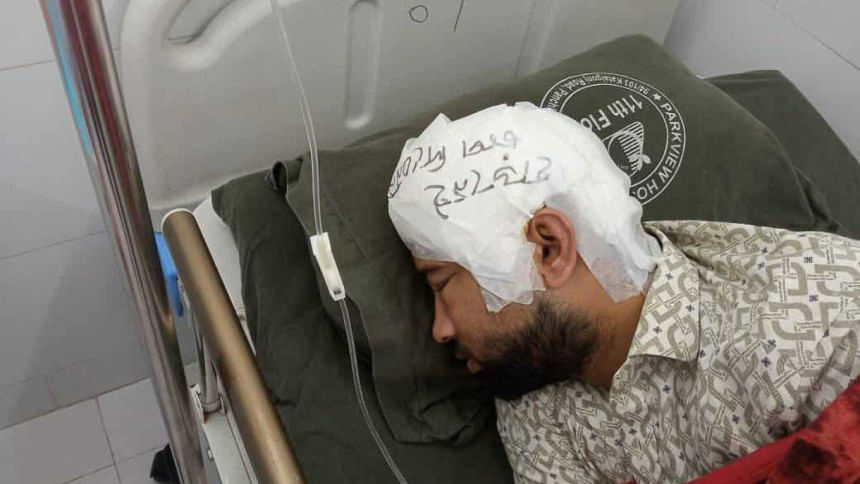 CU student Mamun undergoes successful skull replacement surgery