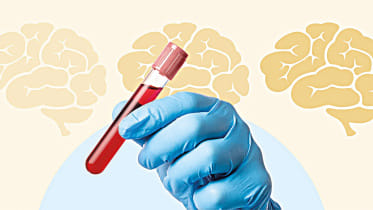 blood-test-Alzheimer.jpg