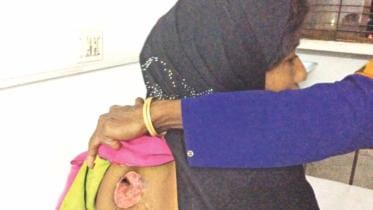 brutality of myanmar army 2.jpg