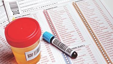 Routine lab investigations in diagnosing