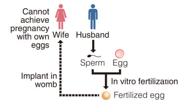Japan birth resulting from an anonymous third-party egg
