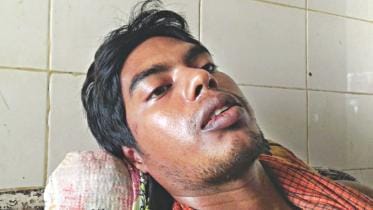 BCL leader attack on quota reformists