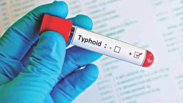 A breakthrough for preventing typhoid fever