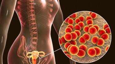 UR for 14 feb 2025.jpg