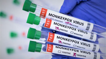 Monkeypox Virus Monkeypox Virus