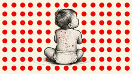 measles deaths in Bangladesh latest update