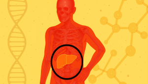 How to reverse fatty liver naturally: Expert-recommended diet tips