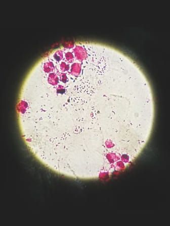 disease