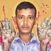 Bangladesh tree-man Bangladesh tree-man