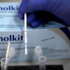 diagnostic test kit for cholera disease diagnostic test kit for cholera disease