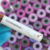 coronavirus test coronavirus test
