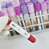 Hepatitis B During Pregnancy: Newborns at risk of liver cirrhosis, cancer Hepatitis B virus