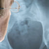 osteoporosis-related bone fractures osteoporosis-related bone fractures