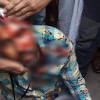 Journalist Mostafizur Rahman Sumon comes under attack  Journalist Mostafizur Rahman Sumon comes under attack