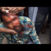Journalist Sumon attacked Journalist Sumon attacked
