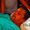 US-Bangla plane crash survivor Kabir Hossain  US-Bangla plane crash survivor Kabir Hossain