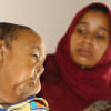 Senile Kid Bayezid Senile Kid Bayezid, Progeria