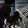 Zika