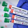 Monkeypox Virus Monkeypox Virus