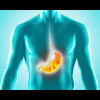 All you need to know about peptic ulcer: Causes, symptoms, and treatment Peptic Ulcer Treatment