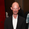 ‘Game of Thrones’ actor Darren Kent passes away ‘Game of Thrones’ actor Darren Kent passes away