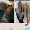 Healing burns! The remarkable benefits of tilapia skin Healing burns! The remarkable benefits of tilapia skin