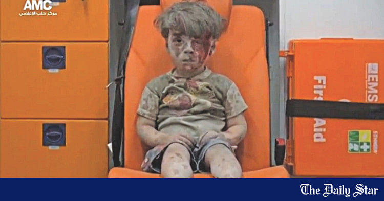 Omran Daqneesh Human Face Of Syria War 