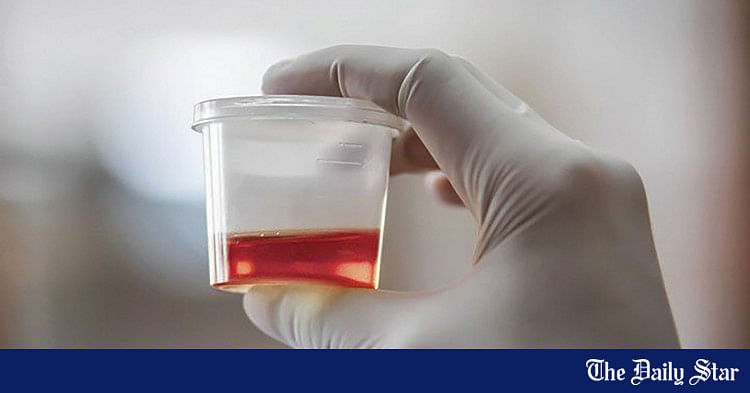 Reasons For Blood In Your Urine The Daily Star   Blood 