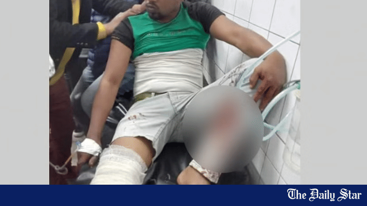 JCD leader shot in leg 'by BCL man' in Narsingdi - Vimarsana News