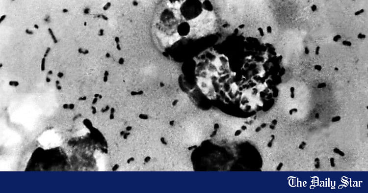 us-officials-confirm-rare-human-case-of-bubonic-plague