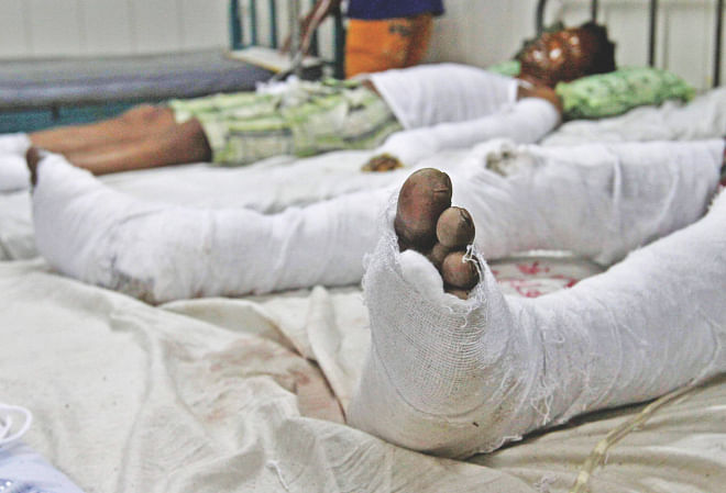 Wrapped in bandages, victims, of the explosion at the burn unit of Dhaka Medical College Hospital.  Photo: Palash Khan, Anisur Rahman