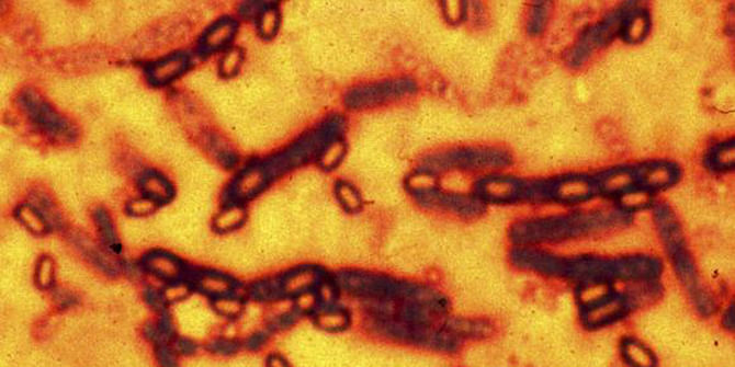 A microscopic picture of spores and vegetative cells of Bacillus anthracis which causes the disease anthrax is pictured in this undated file photograph. Photo: Reuters